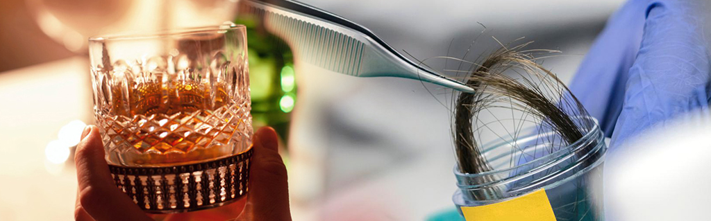 Hair Test for Alcohol Detection - DNA Forensics Laboratory